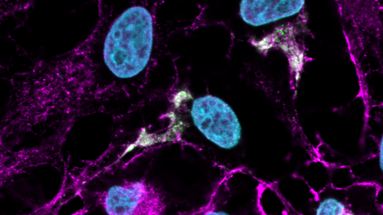 Blue and magenta cells against a dark background